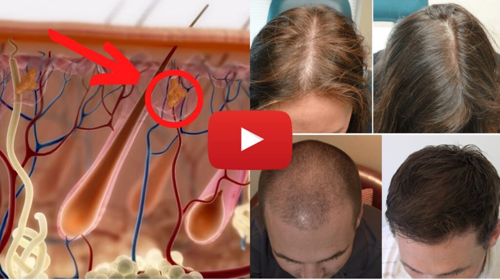Hair thinning presentation preview